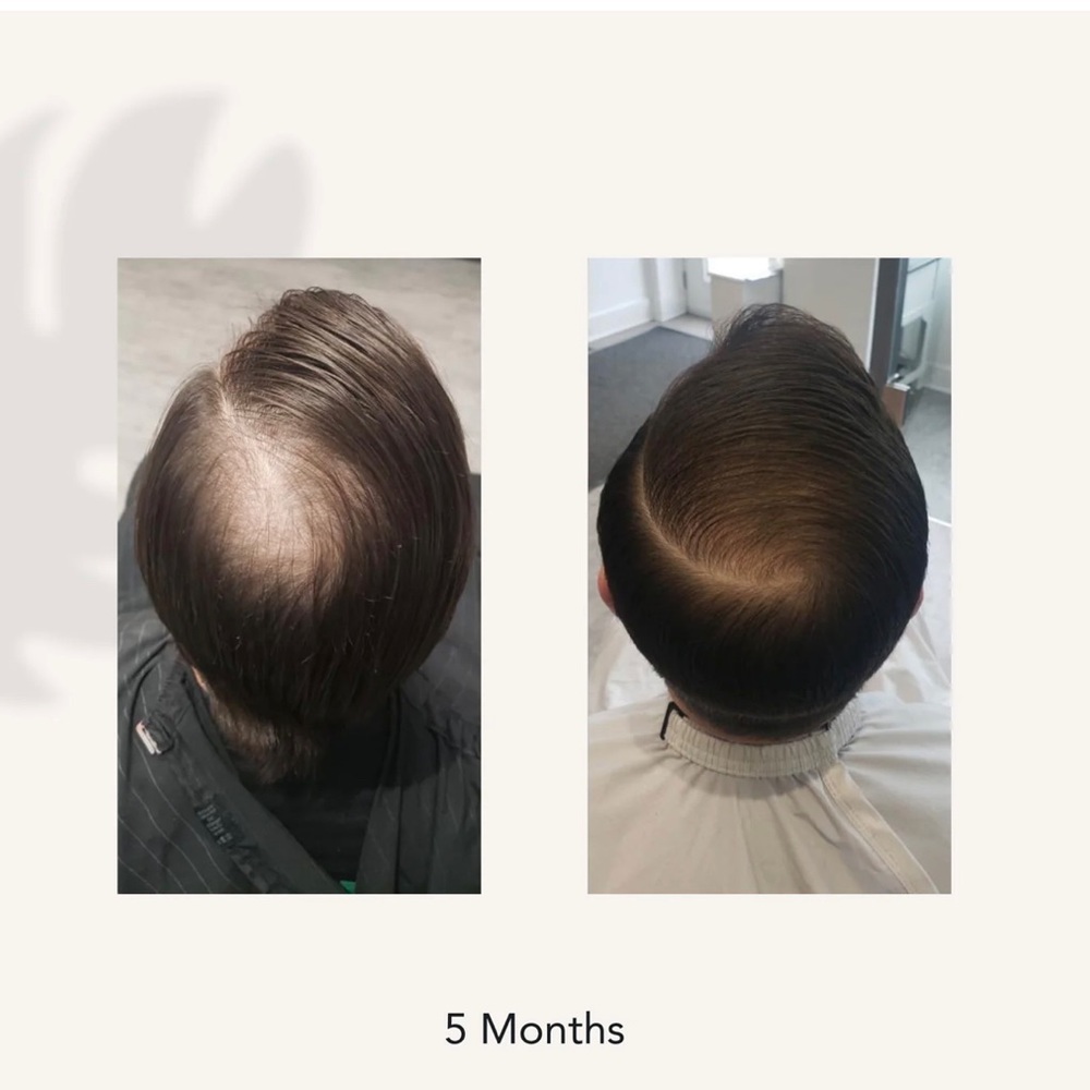 Travel size RECOVER THICKENING SHAMPOO TREATMENT FOR MEN